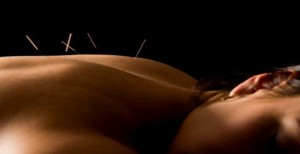 acupuncture_for_back_pain-549x283
